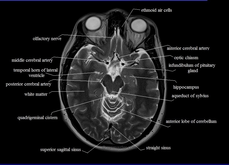 Anatomy – Indian Radiological And Imaging Association