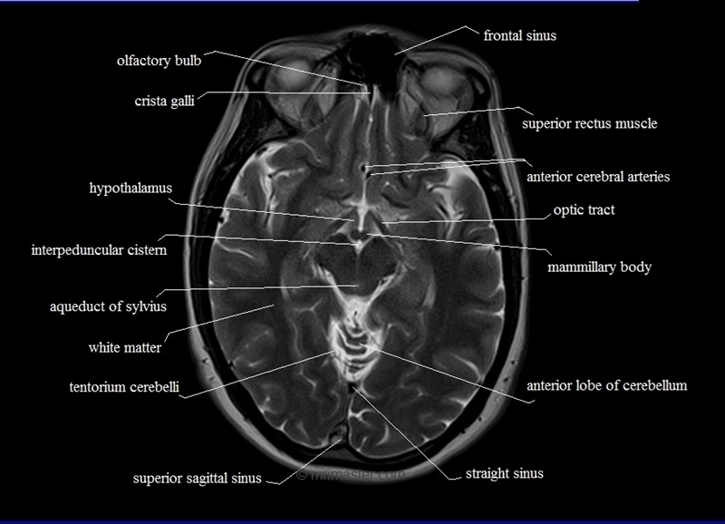 Anatomy – Indian Radiological And Imaging Association