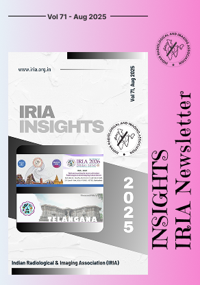 IRIA_insights_Aug2025